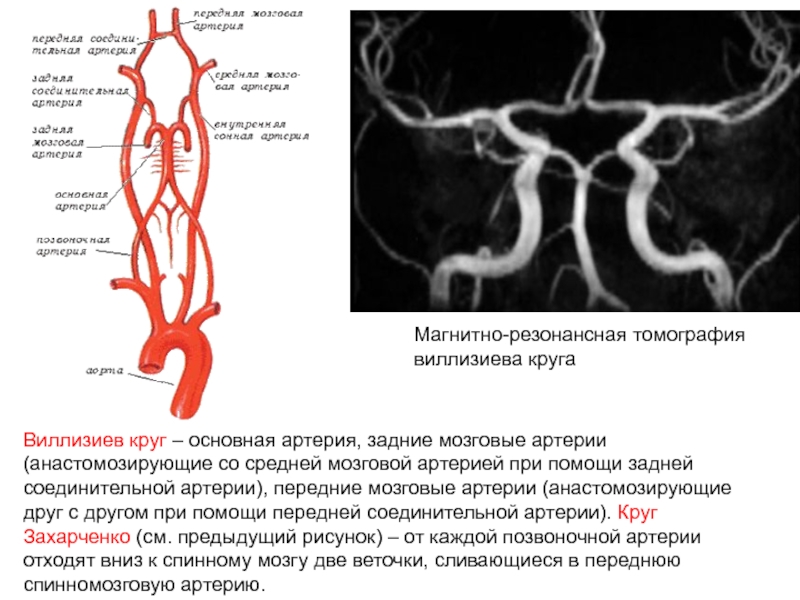 Правая задняя трифуркация. Артерии головного мозга Виллизиев круг схема. Основные сосуды артериального Виллизиева круга. Виллизиева круга головного мозга. Сосуды виллизиевого круга мрт.