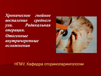 Хроническое гнойное воспаление среднего уха. Радикальная операция. Отогенные внутричерепные осложнения