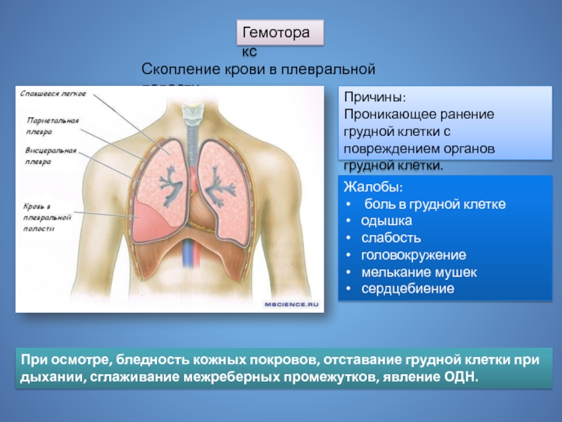 Реферат: Повреждения грудной клетки и органов грудной полости