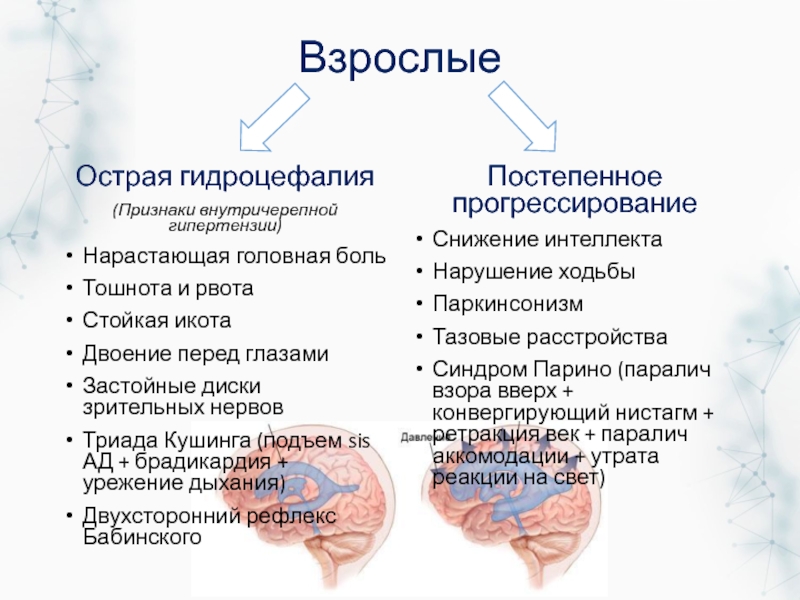 Гидроцефалия лечение