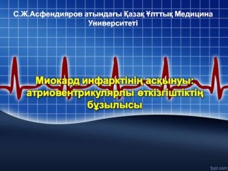 Кардиология. Инфаркт миокарда