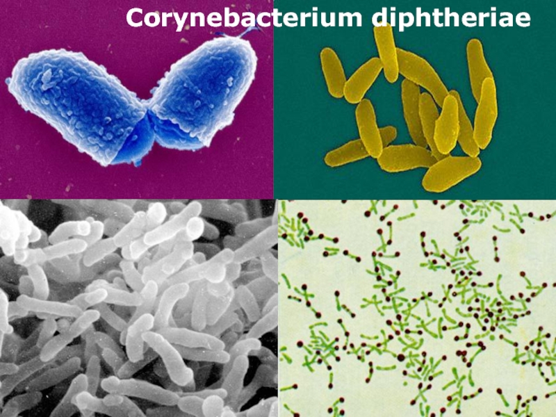 Corynebacterium diphtheriae фото