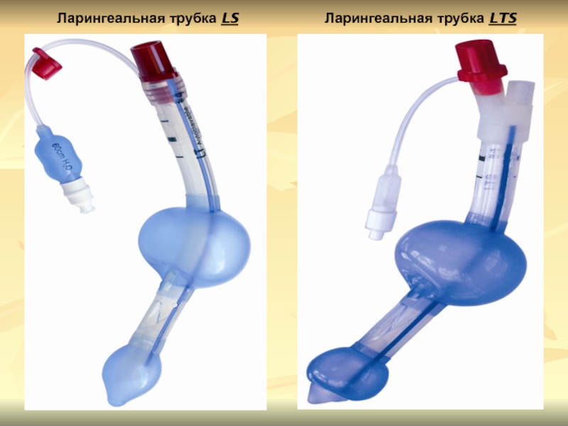 Ларингеальная трубка фото