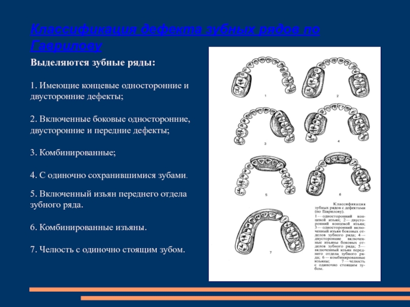 Классификация суппле картинки