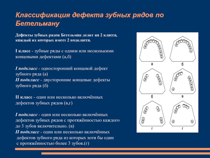 7 дефект. Дефекты зубных рядов по Кеннеди. Классификация дефектов зубных рядов Кеннеди. Дефекты зубных рядов по Кеннеди и Гаврилову. Классификации Кеннеди Гаврилова Бетельмана.