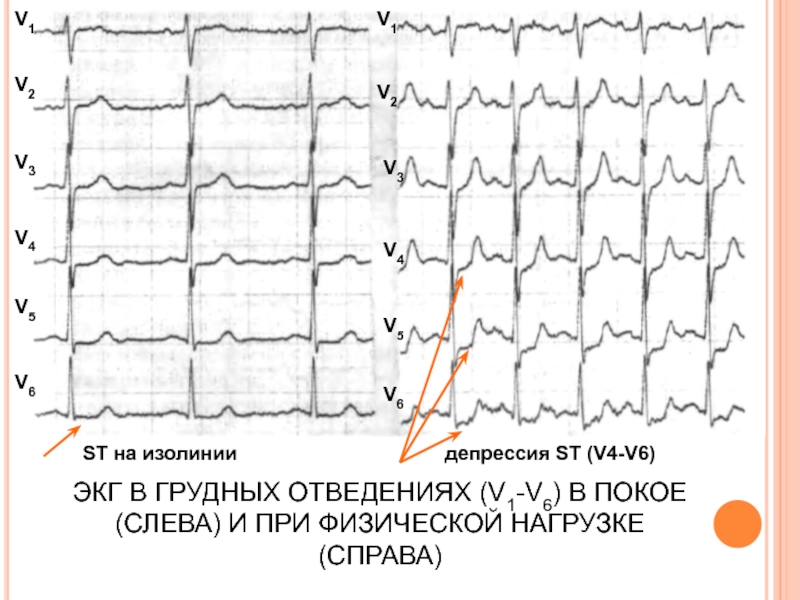 Смещение st вверх v4