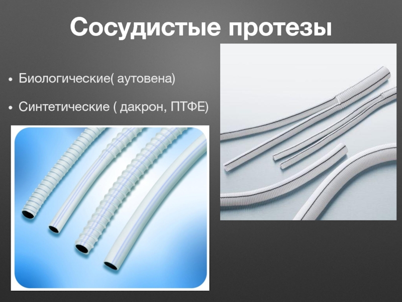 Протезирование сосудов презентация