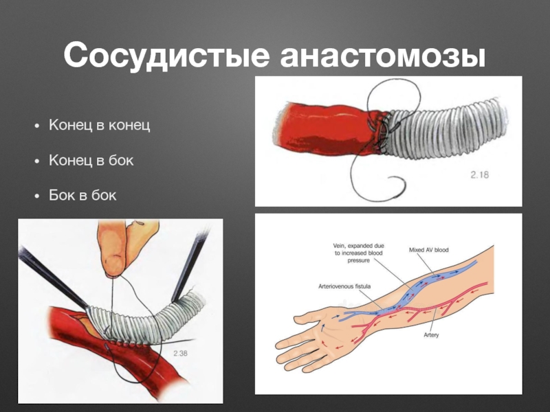 Нарушение кровообращения хирургия презентация