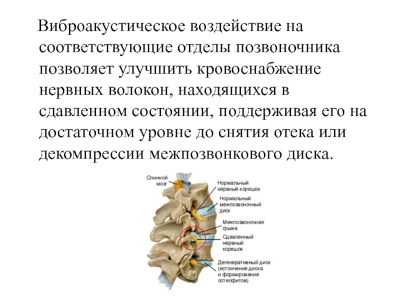 Нервный корешок позвоночника. Кровоснабжение межпозвонкового диска. Перфузия нервного волокна это. Виброакустическое воздействие. Сжатый нервный корешок.