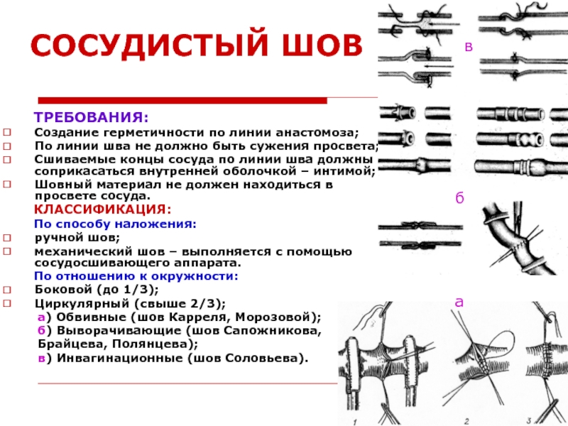 Сосудистый шов топографическая анатомия презентация