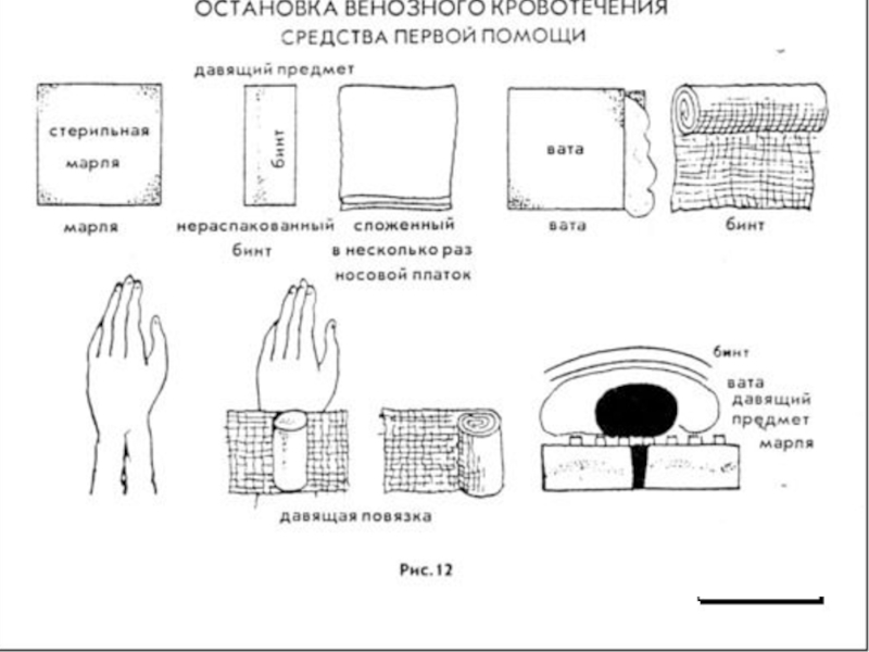 Дополните схему об основных видах бинтов средние