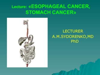 Esophageal cancer, stomach cancer