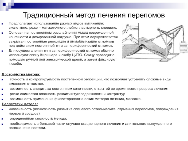 События обозначенные на схеме являются частью коренного перелома в ходе