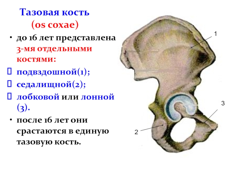 Срослись подвздошные кости. Тазовая кость представлена тремя отдельными костями подвздошной. Подвздошно лобковое возвышение. Седалищная и подвздошная кость. Подвздошная и седалищная кости таза.