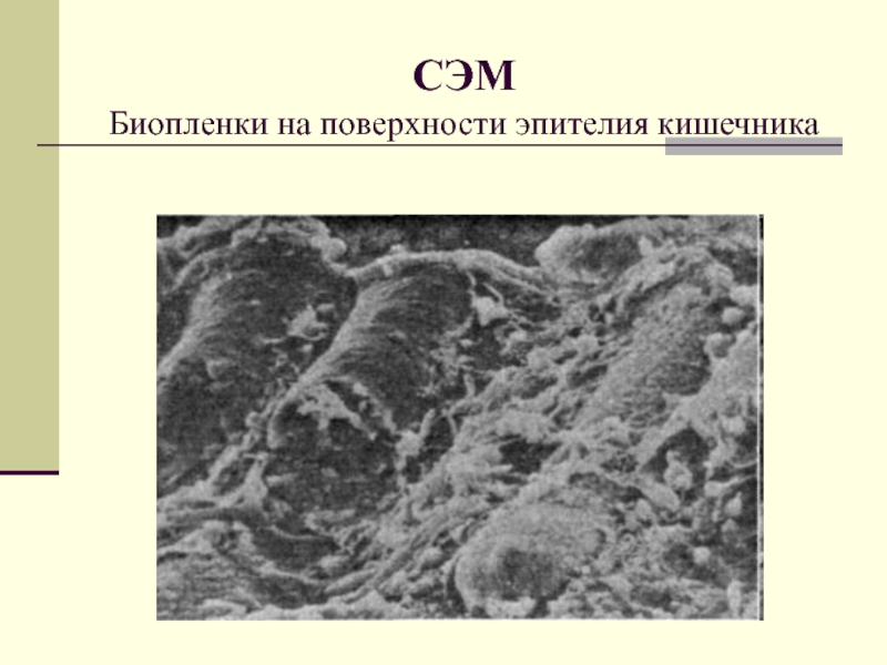 Биопленки кандиды. Биопленка микробиология строение. Биопленка бактерий. Строение биопленки. Биопленки на поверхностях.