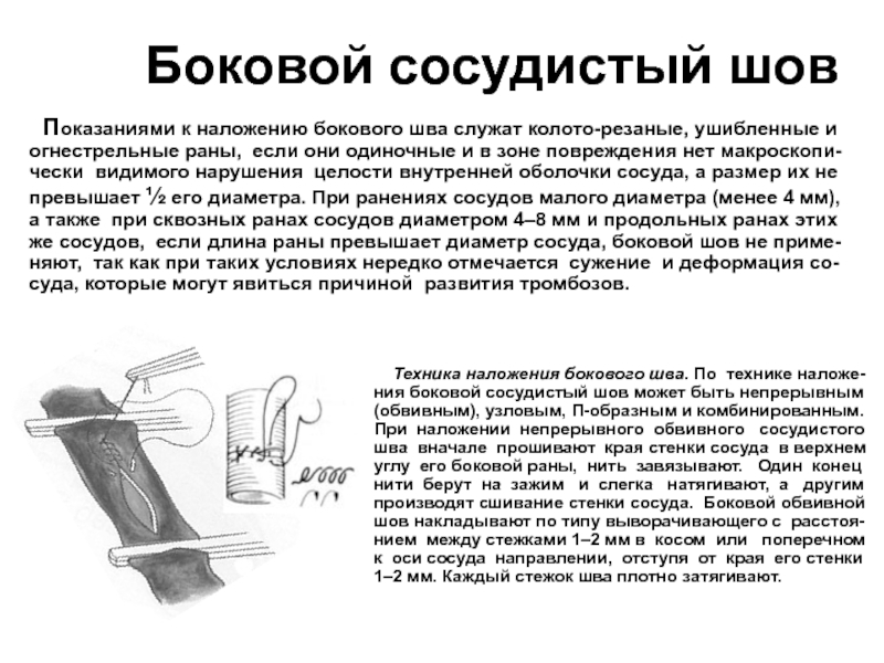 Сосудистый шов методы наложения. Принципы наложения сосудистого шва. Боковой сосудистый шов. Сосудистые швы техника наложения. Циркулярный сосудистый шов.