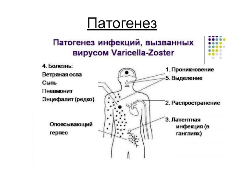 Схема лечения ветрянки