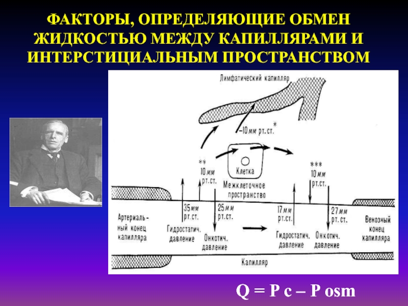 Обмен жидкостями. Обмен жидкости между капиллярами. Факторы определяющие обмен жидкости капиллярами и ткани по стадленгу. P ОСМ крови. Разрушитель обмен жидкостями.