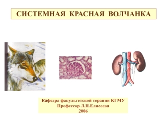 Системная красная волчанка