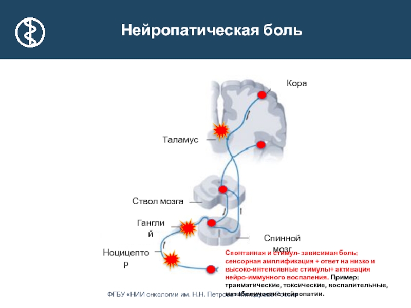 Нейропатическая боль