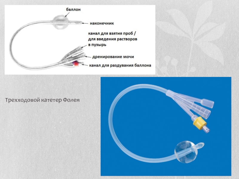 Аккредитация уход за постоянным мочевым катетером фолея. Катетер Фолея трехходовой. Мочевой трехходовой катетер Фолея. Катетер Фолея с датчиком температуры. Трехходовой катетер Фолея принцип.
