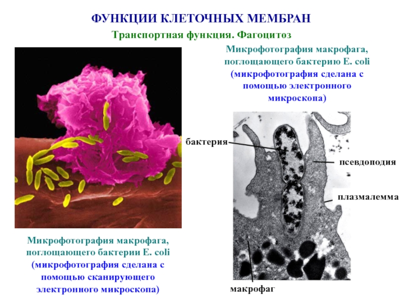 Макрофаги фагоцитоз. Фагоцит микрофотография. Макрофаги электронная микроскопия. Макрофаг фагоцитоз бактерию. Макрофаги это клетки.