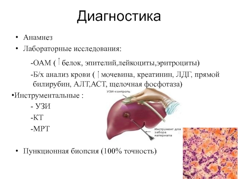 Гепатоза гепатомегалии