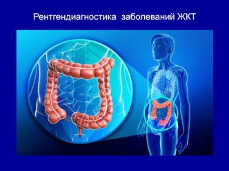 Рентгендиагностика заболеваний ЖКТ