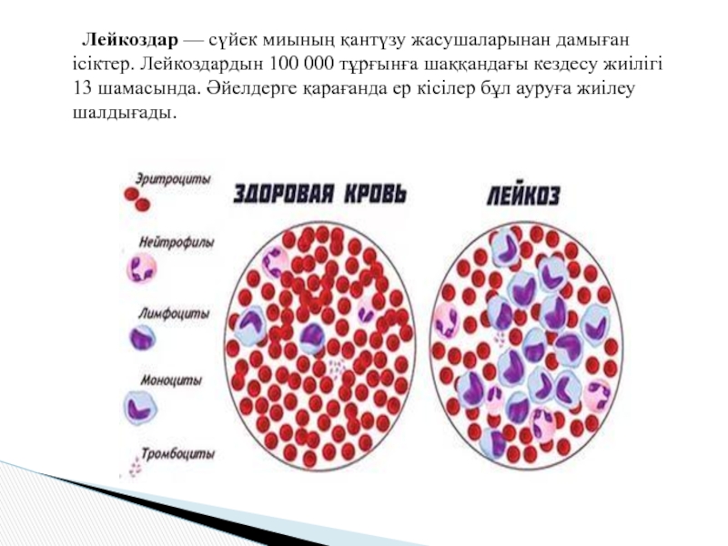 Хронические лейкозы презентация