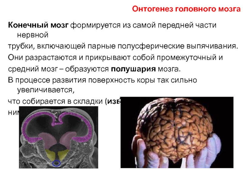 Как появился мозг. Из среднего мозга формируется. Как мозг формирует привычку. Когда закладывается мозг.