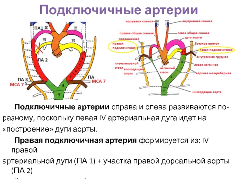 Сонно подключичное шунтирование схема операции