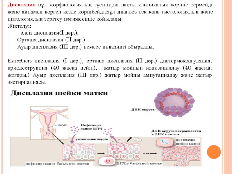 Дисплазия 2 степени что это такое