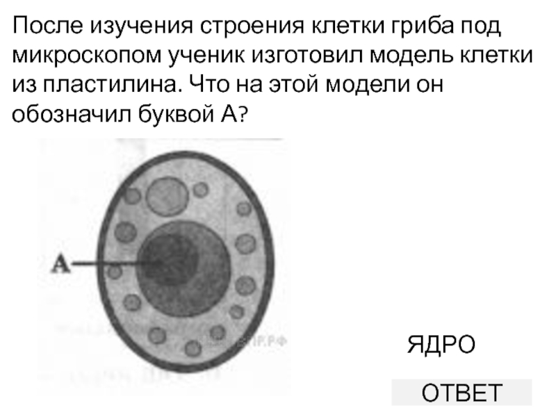 Клетка впр. Строение клетки гриба под микроскопом. Клетка гриба под микроскопом. Строение гриба под микроскопом. Структура клетки грибов под микроскопом.