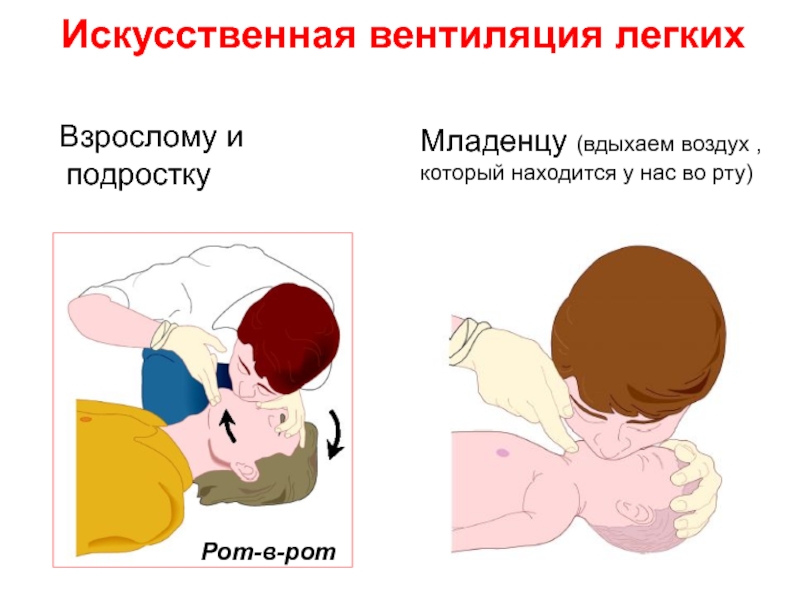 Искусственное дыхание картинки для презентации