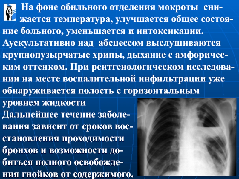 Лекарственное поражение легких презентация