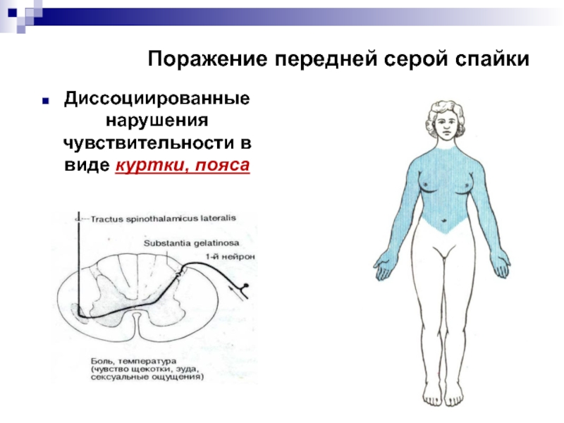 Нарушение чувствительности неврология презентация