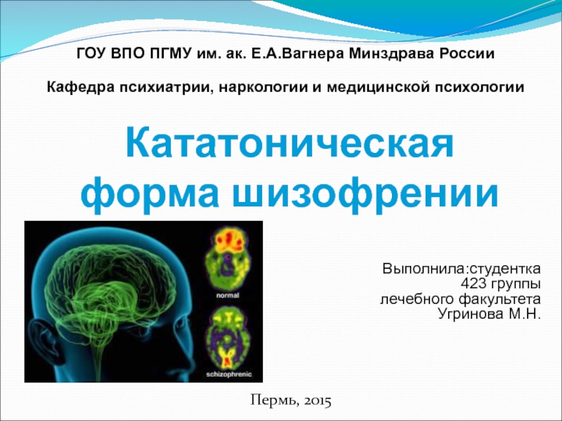 Кататоническая шизофрения презентация