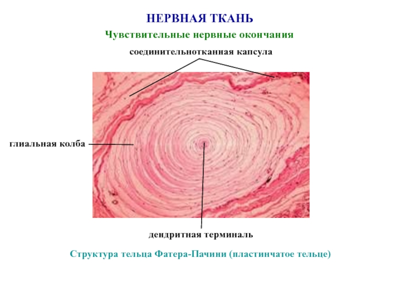 Рассмотрите рисунок ниже и обозначьте структурные компоненты телец пачини