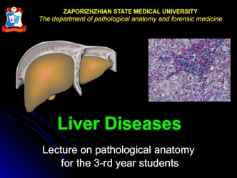 Liver diseases
