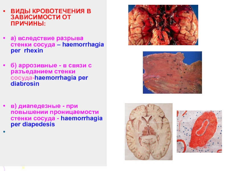 Патология кровообращения и лимфообращения презентация