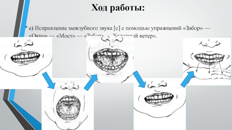 Зубной звук. Коррекция межзубного звука с. Артикуляционная гимнастика при межзубном сигматизме. Межзубное произношение звука с. Коррекция звука с при межзубном сигматизме.