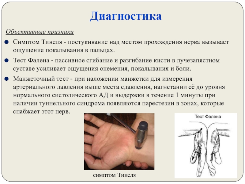 Объективный диагноз. Тест фалена на туннельный синдром.