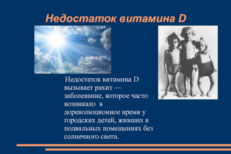 Заболевание развивающееся при недостатке витамина d. Дефицит витамина д. Заболевания при недостатке витамина д. Болезни при недостатке витамина д. Недостаток витамина д вызывает.